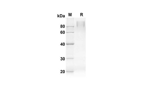 SDS-PAGE analysis of Mouse Csf1r proteins, 2 μg/lane of Recombinant Mouse Csf1r proteins was resolved with an SDS-PAGE under reducing conditions, showing bands at 54.4 kDa.