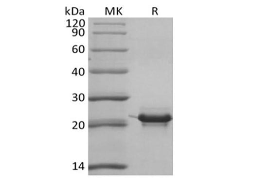 Recombinant Human KRAS4B (N-6His) - ABMIUM