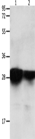 Anti-Human/Mouse/Rat YWHAE Antibody - ABMIUM