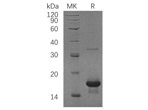 Recombinant Human SH2D1A/SAP Protein (His Tag) - ABMIUM