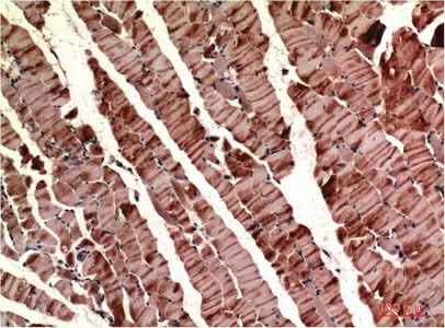 Anti-Human/Mouse/Rat ACTA1 Antibody [2H3]