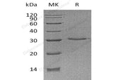 Recombinant Human VSIG8 Protein (His Tag) - ABMIUM