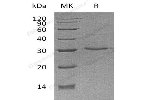 Recombinant Human VSIG8 Protein (His Tag) - ABMIUM