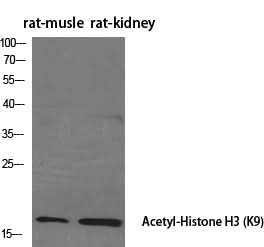 Western Blot analysis of Rat muscle, kindey using Acetyl-Histone H3 (Lys9) Polyclonal Antibody at dilution of 1:2000.