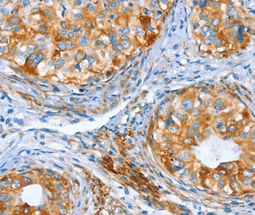 Anti-Human/Mouse/Rat AIP Antibody - ABMIUM