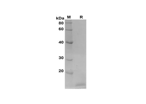 SDS-PAGE analysis of Rat IGF proteins, 2 μg/lane of Recombinant Rat IGF proteins was resolved with SDS-PAGE under reducing conditions, showing bands at 15 kDa.