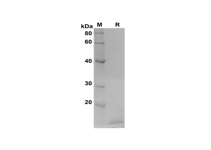 SDS-PAGE analysis of Rat IGF proteins, 2 μg/lane of Recombinant Rat IGF proteins was resolved with SDS-PAGE under reducing conditions, showing bands at 15 kDa.