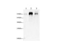 Anti-Human/Mouse/Rat FLNC Antibody - ABMIUM