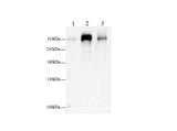 Anti-Human/Mouse/Rat FLNC Antibody - ABMIUM