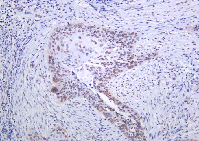 Anti-Human/Mouse/Rat SRSF2 Antibody [B1038]