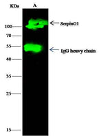 Anti-Human SerpinG1 Antibody [A1215] - ABMIUM
