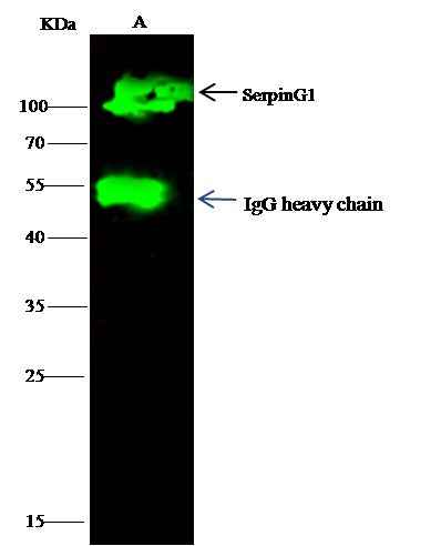 Anti-Human SerpinG1 Antibody [A1215] - ABMIUM