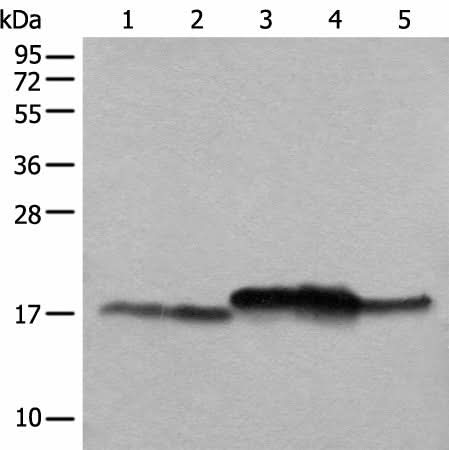 Western blot analysis of Mouse brain tissue Mouse liver tissue 231 cell K562 cell A431 cell lysates using NDUFB11 Polyclonal Antibody at dilution of 1:1000