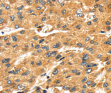 Anti-Human/Mouse/Rat SH3KBP1 Antibody - ABMIUM