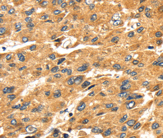 Anti-Human/Mouse/Rat SH3KBP1 Antibody - ABMIUM