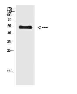 Western Blot analysis of Hela cells using Phospho-Vimentin (Tyr38) Polyclonal Antibody at dilution of 1:500.