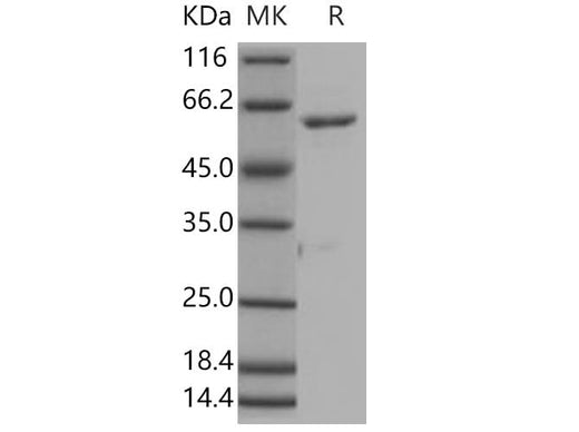 Recombinant Human ROR1 Protein (aa 453-783, His & GST Tag) - ABMIUM