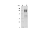SDS-PAGE analysis of Mouse IL-18 BPa proteins , 2 μg/lane of Recombinant Mouse IL-18 BPa proteins was resolved with SDS-PAGE under reducing conditions , showing bands at 60 kDa.