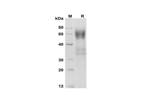 SDS-PAGE analysis of Mouse IL-18 BPa proteins , 2 μg/lane of Recombinant Mouse IL-18 BPa proteins was resolved with SDS-PAGE under reducing conditions , showing bands at 60 kDa.