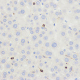 Immunohistochemistry analysis of paraffin-embedded mouse liver using CD45 Polyclonal Antibody at dilution of 1:500.