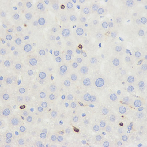 Immunohistochemistry analysis of paraffin-embedded mouse liver using CD45 Polyclonal Antibody at dilution of 1:500.
