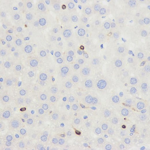 Immunohistochemistry analysis of paraffin-embedded mouse liver using CD45 Polyclonal Antibody at dilution of 1:500.