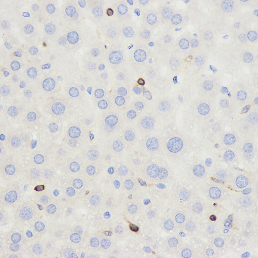Immunohistochemistry analysis of paraffin-embedded mouse liver using CD45 Polyclonal Antibody at dilution of 1:500.
