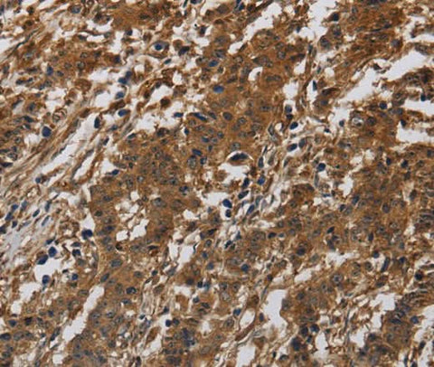 Anti-Human ITGB7 Antibody - ABMIUM