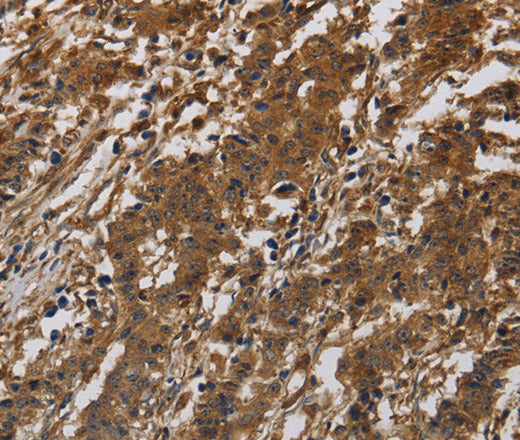 Anti-Human ITGB7 Antibody - ABMIUM