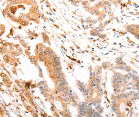 Anti-Human ABCA4 Antibody