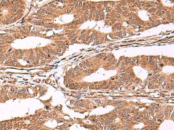 Anti-Human/Mouse/Rat IST1 Antibody