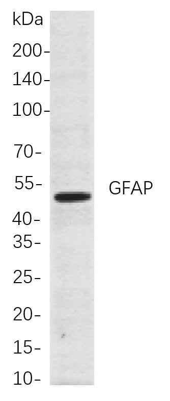 Anti-Human/Mouse/Rat GFAP Antibody [B726] - ABMIUM