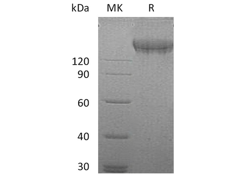 Recombinant Human VEGFR2/Flk-1/KDR Protein (Fc Tag) - ABMIUM