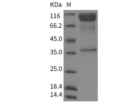 > 90 % as determined by reducing SDS-PAGE.