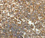 Anti-Human SFTPD Antibody - ABMIUM