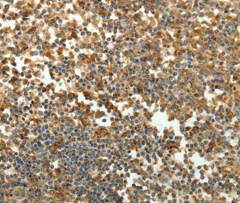 Anti-Human SFTPD Antibody