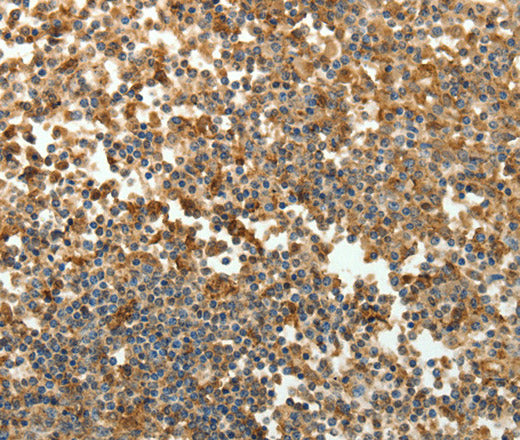Anti-Human SFTPD Antibody - ABMIUM