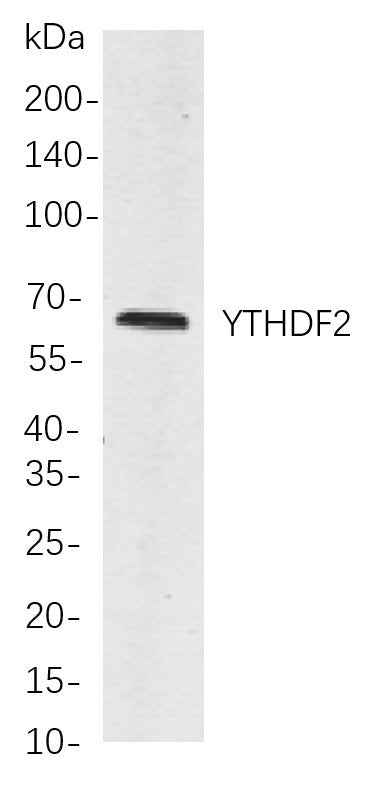 Anti-Human/Mouse/Rat YTHDF2 Antibody [B866] - ABMIUM