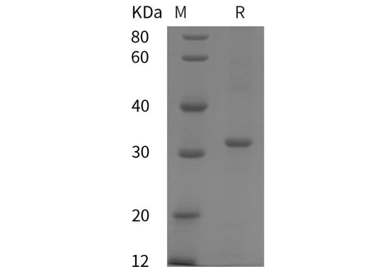 SDS-PAGE analysis of Human ALDOA proteins, 2 μg/lane of Recombinant Human ALDOA proteins was resolved with SDS-PAGE under reducing conditions, showing bands at 32 kDa.