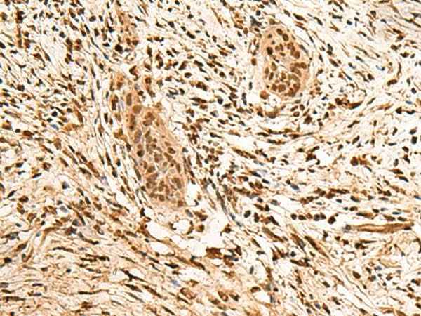 Anti-Human/Mouse/Rat PPM1G Antibody