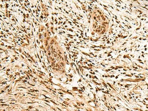 Anti-Human/Mouse/Rat PPM1G Antibody