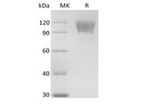 Recombinant Human TNFRSF8/CD30L Receptor/CD30 (C-mFc) - ABMIUM