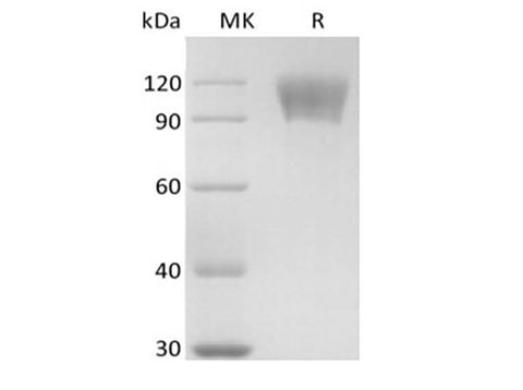 Recombinant Human TNFRSF8/CD30L Receptor/CD30 (C-mFc) - ABMIUM