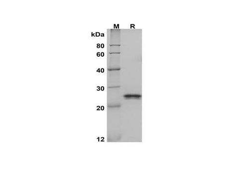 SDS-PAGE analysis of Mouse Lcn2 proteins, 2 μg/lane of Recombinant Mouse Lcn2 proteins, was resolved with SDS-PAGE under reducing conditions, showing bands at 25 kDa.