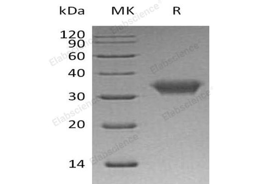 Recombinant Human CXADR/CAR Protein (His Tag) - ABMIUM