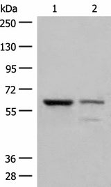 Western blot analysis of Human left kidney cancer tissue and HEPG2 cell lysates using HNF1A Polyclonal Antibody at dilution of 1:200