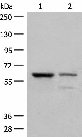 Western blot analysis of Human left kidney cancer tissue and HEPG2 cell lysates using HNF1A Polyclonal Antibody at dilution of 1:200
