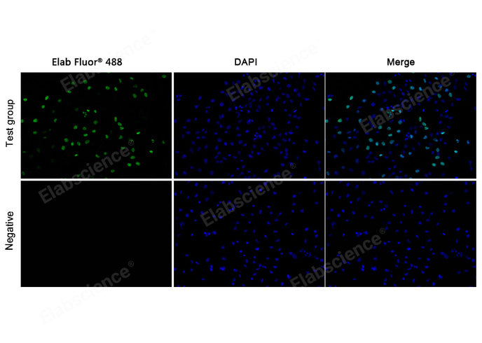 Test: Hela cells were treated with 10 μM EdU for 2 hours. Negative: Hela cells without EdU.