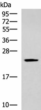 Western blot analysis of Human fetal liver tissue lysate using CMPK1 Polyclonal Antibody at dilution of 1:700