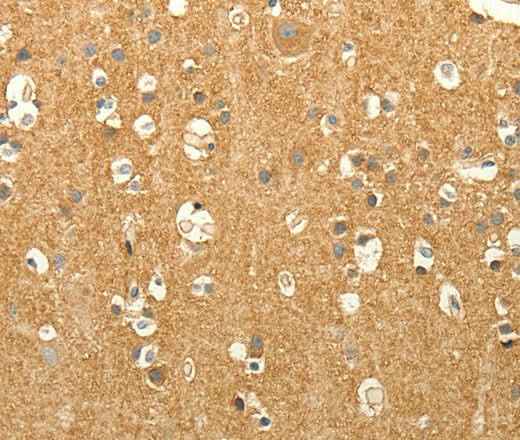 Anti-Human/Mouse/Rat EDG7 Antibody